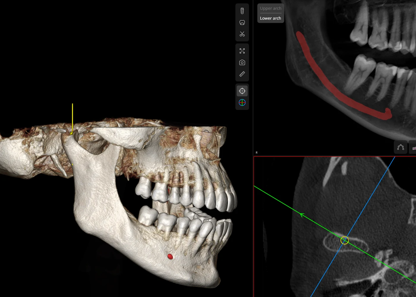 In-house 3D CBCT scan showing the jaw joint, bone and bite in the viewer at Smile Spot Dentistry, Venice FL