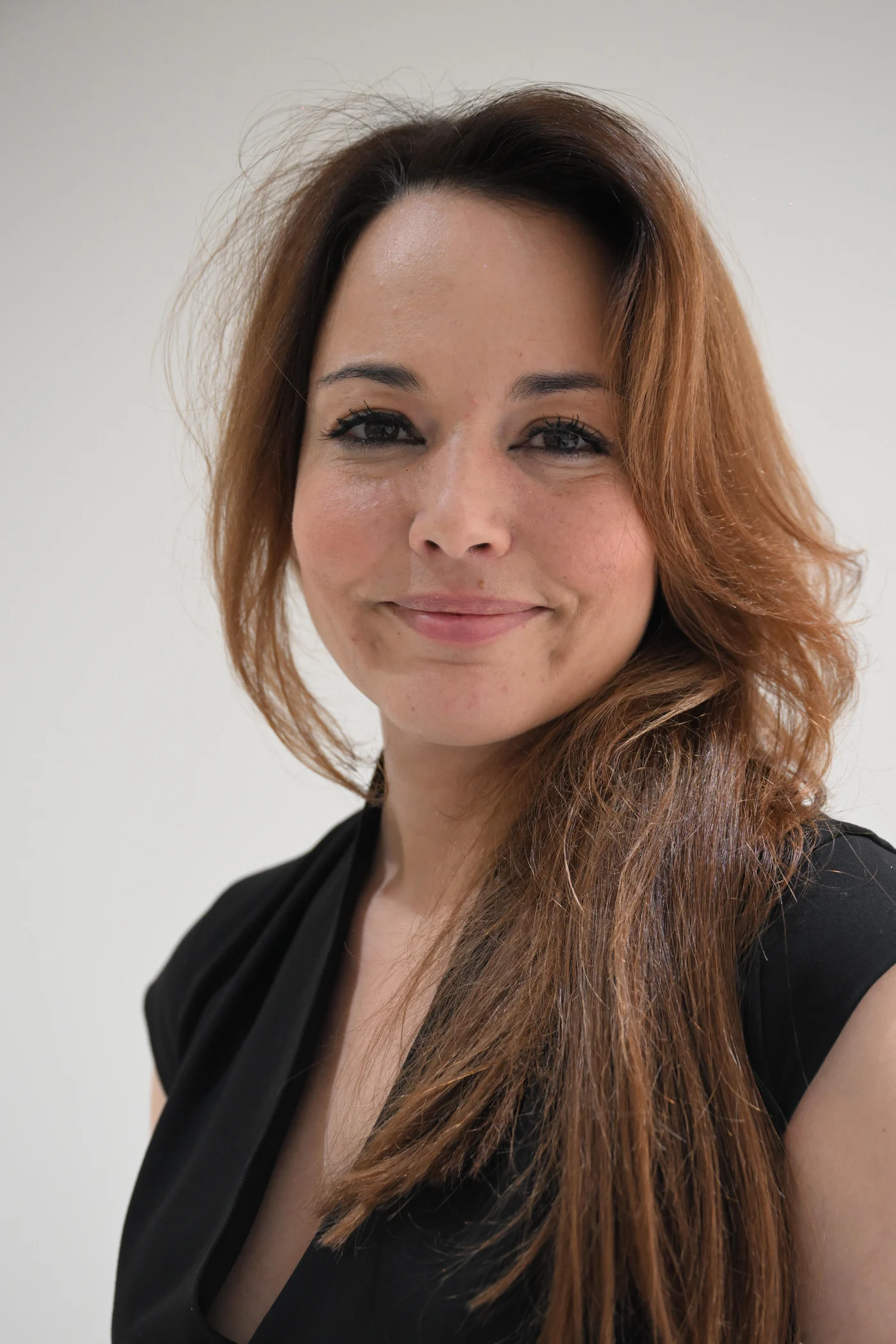 Woman with a relaxed, natural expression — the goal of Botox at Smile Spot Dentistry, Venice, Florida