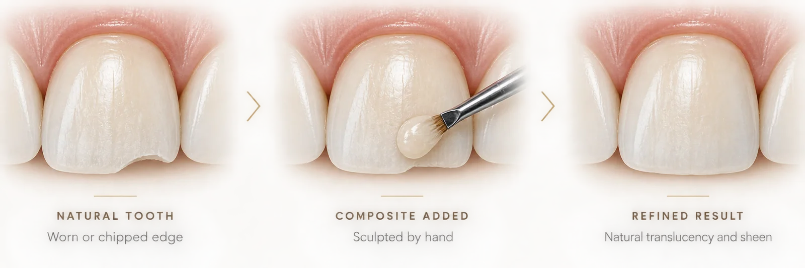 Illustration of cosmetic bonding in three steps: natural tooth with a worn or chipped edge; composite added and sculpted by hand; refined result with natural translucency and sheen. Illustrative example — not an actual patient.