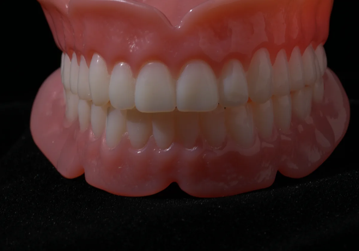Premium denture arch showing individual tooth characterization — natural variations, subtle rotations, and surface texture that distinguish a boutique prosthetic from a standard denture. Smile Spot Dentistry Venice FL.