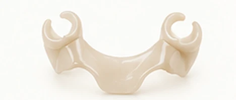 BioHPP metal-free partial denture framework — Smile Spot Dentistry, Venice FL