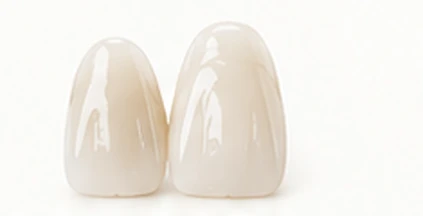 High-grade composite denture teeth — Smile Spot Dentistry, Venice FL
