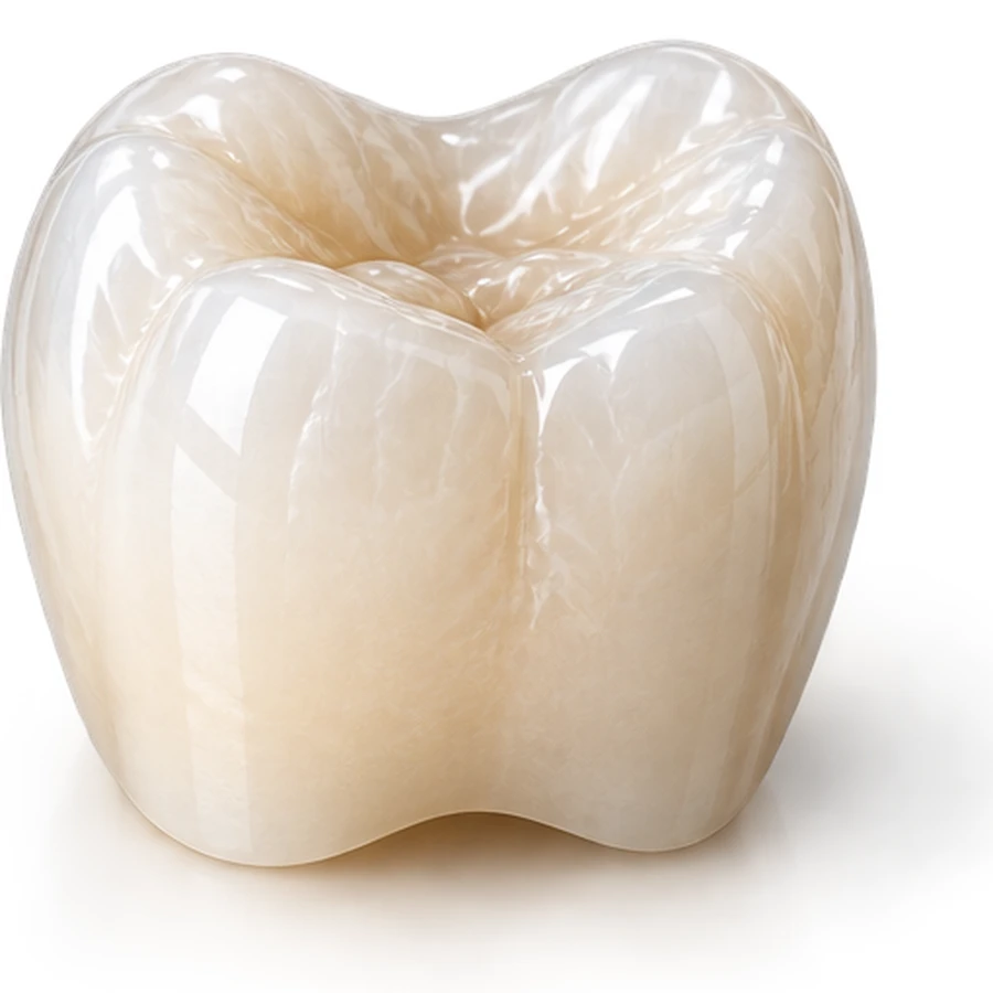E.max crown backlit showing translucency — Smile Spot Dentistry Venice FL