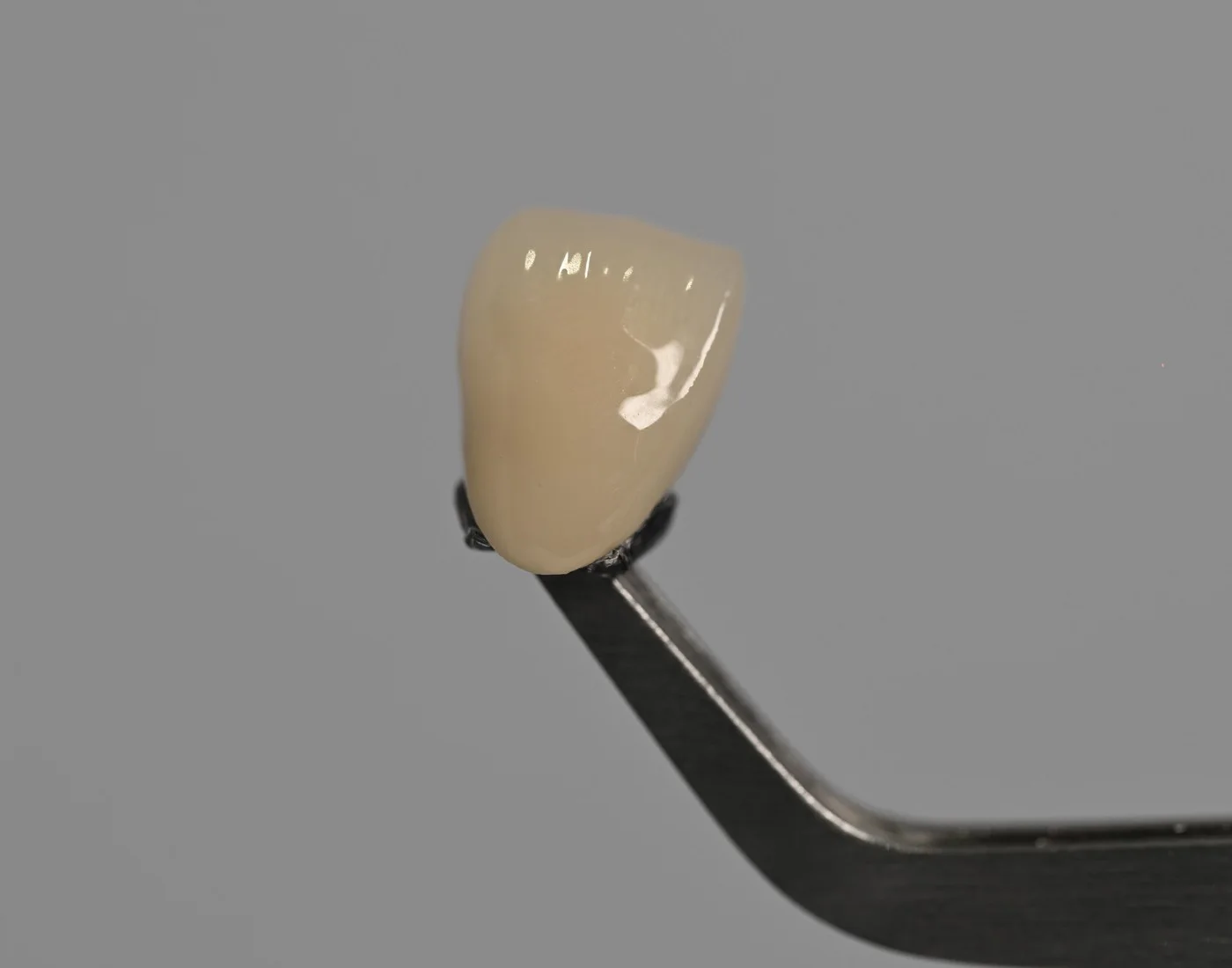 Final ceramic implant crown held in tweezers — Smile Spot Dentistry, Venice, FL