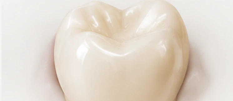 Molar restored with a full biomimetic crown — restoration hierarchy, Smile Spot Dentistry, Venice FL