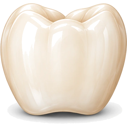 Crown — dental implant component, Smile Spot Dentistry, Venice, FL