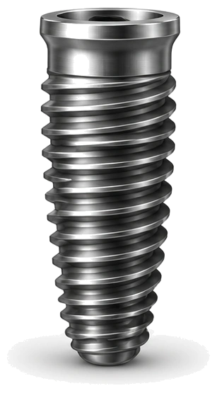 Implant — dental implant component, Smile Spot Dentistry, Venice, FL