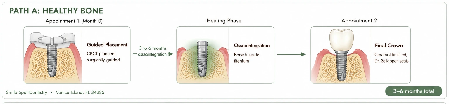 Path A: Healthy bone — stage by stage, Smile Spot Dentistry, Venice, FL