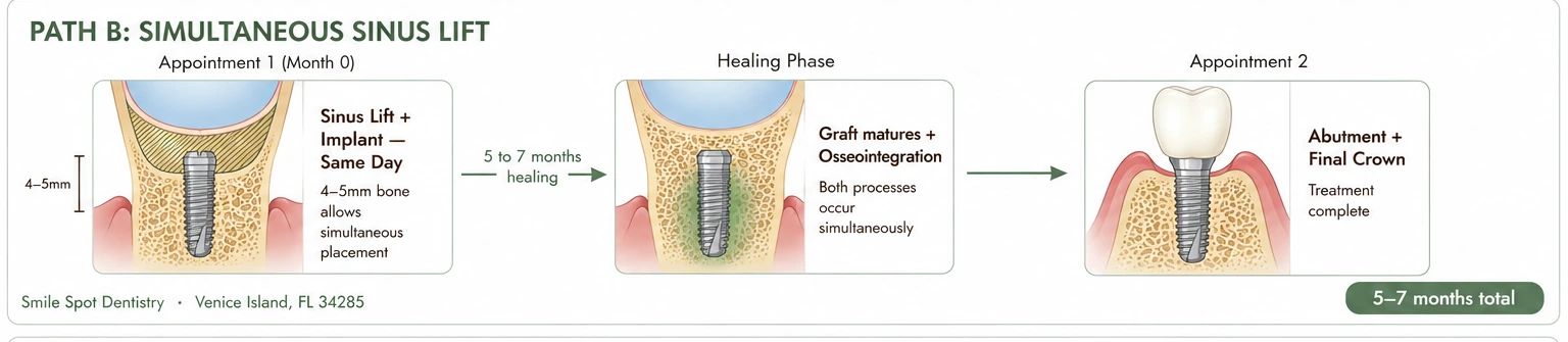 Path B: Simultaneous sinus lift — stage by stage, Smile Spot Dentistry, Venice, FL