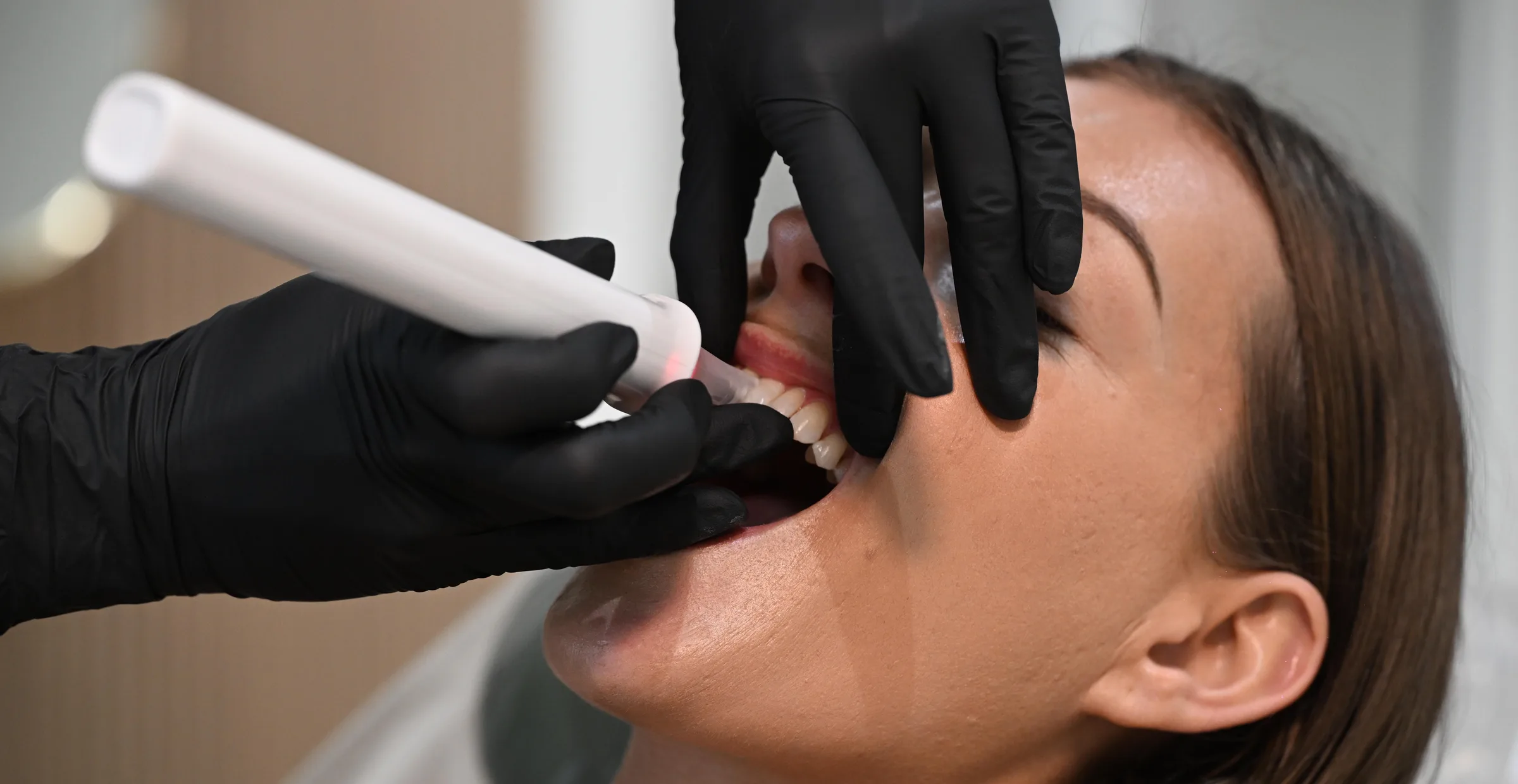 Innerview QPD percussion diagnostics at Smile Spot Dentistry, Venice FL