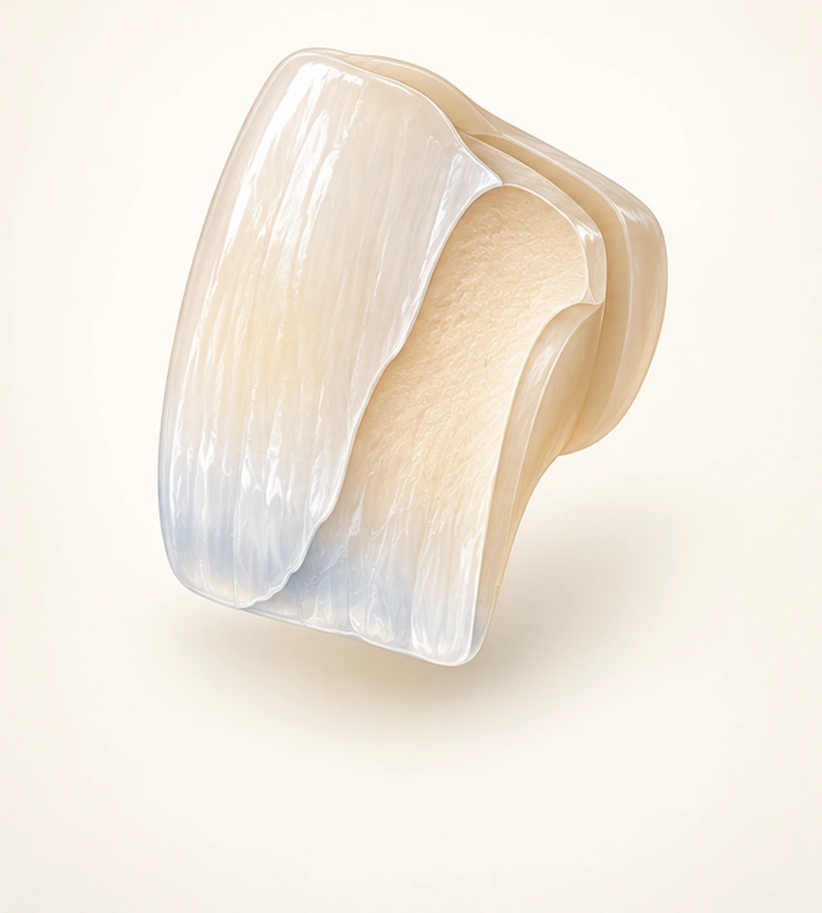 Illustration of a layered feldspathic porcelain crown showing its enamel and dentin layers
