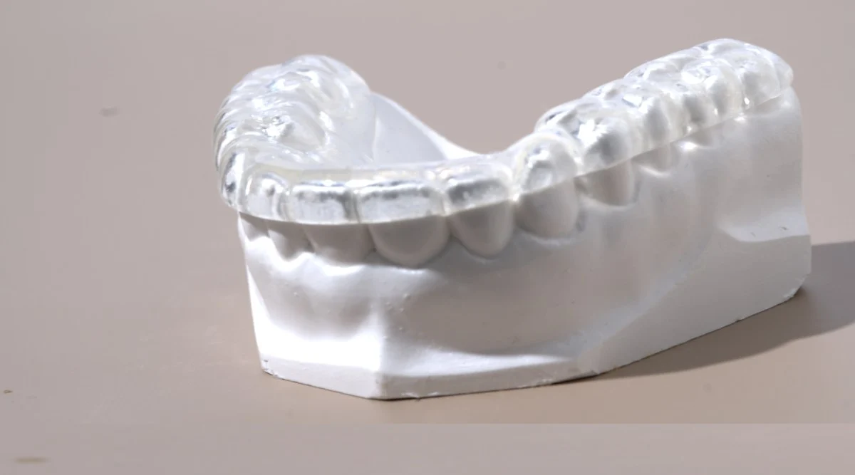 Custom nightguard on a dental model — Smile Spot Dentistry, Venice FL