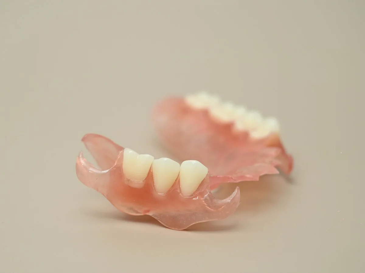 Custom metal-free partial denture — Smile Spot Dentistry, Venice FL