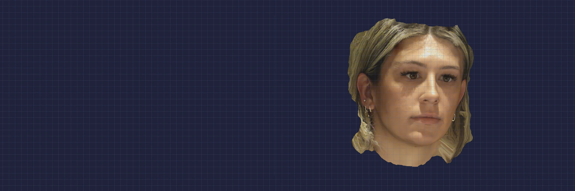 RayFace 3D facial scan used to design dentures around the patient's face — facial midline, lip curvature and smile arc. Smile Spot Dentistry, Venice FL.