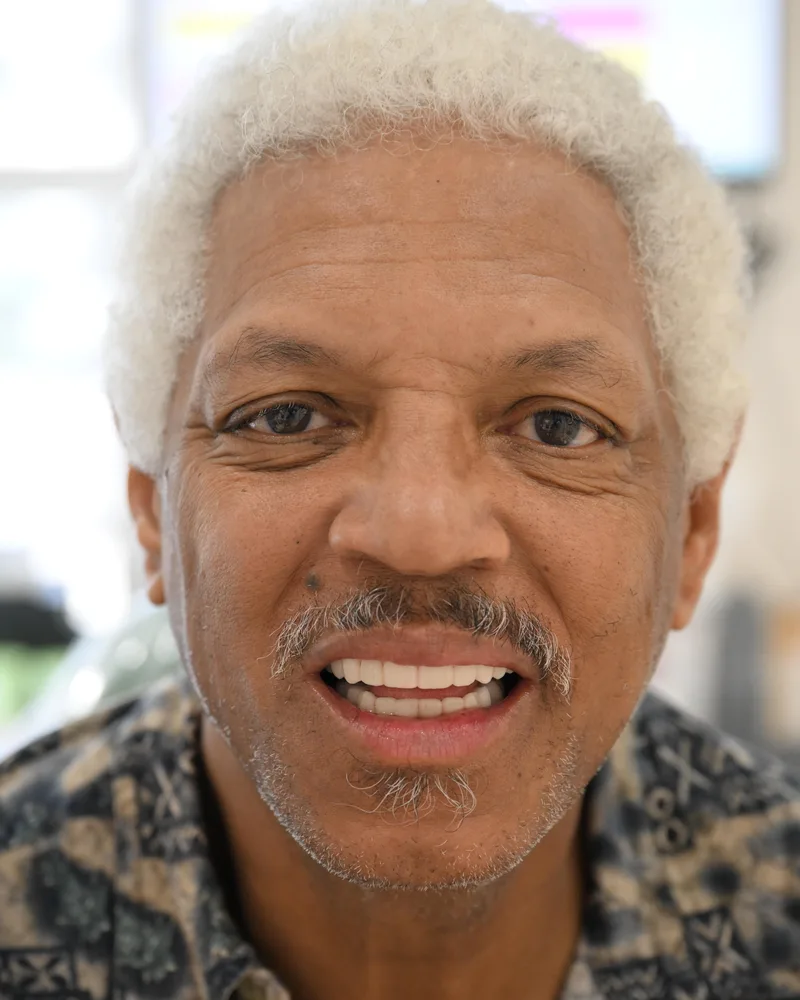 Patient smiling with his new fixed teeth the same afternoon