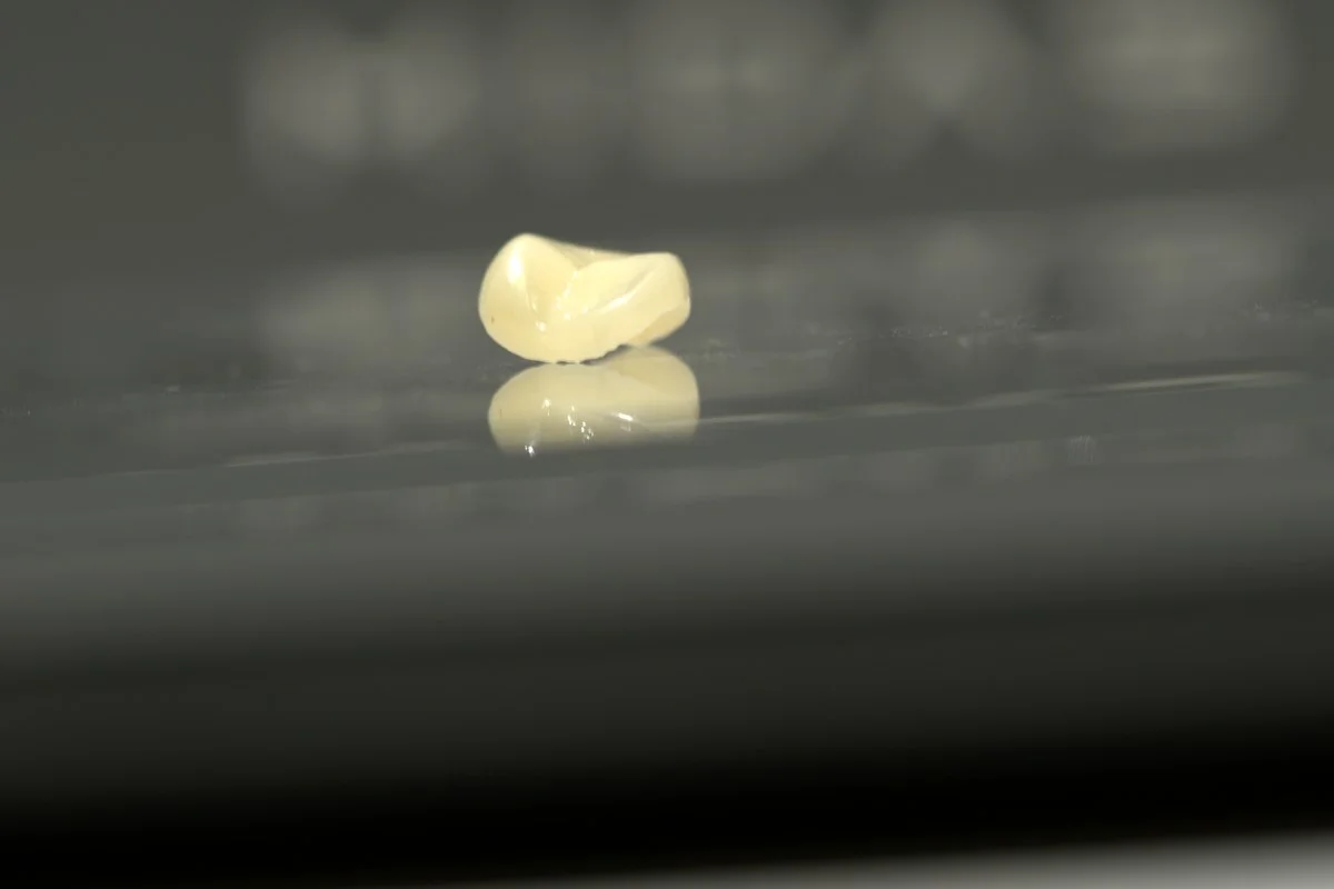 Freshly printed Midas ceramic inlay in front of the SprintRay Midas printer — Smile Spot Dentistry, Venice FL