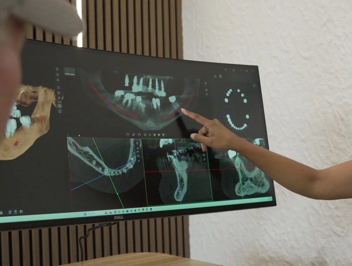Reviewing a CBCT 3D scan and panoramic slice on screen — diagnosis and functional planning, Smile Spot Dentistry, Venice FL