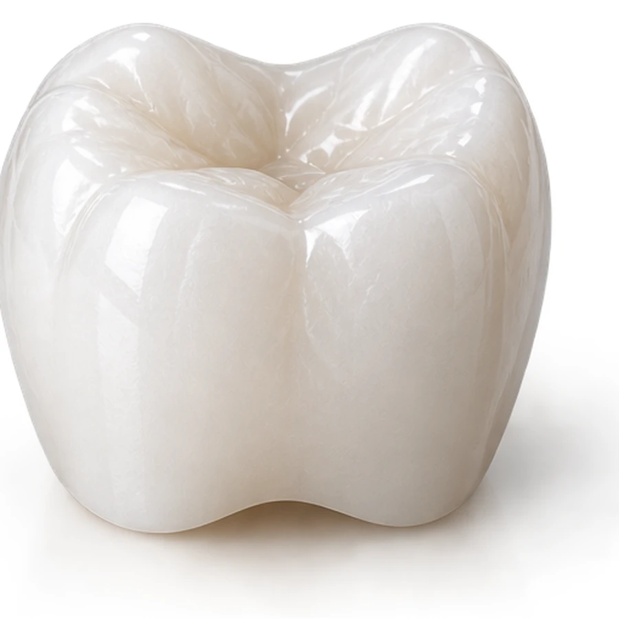 Monolithic zirconia crown — Smile Spot Dentistry Venice FL